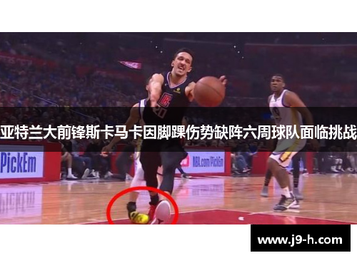 亚特兰大前锋斯卡马卡因脚踝伤势缺阵六周球队面临挑战